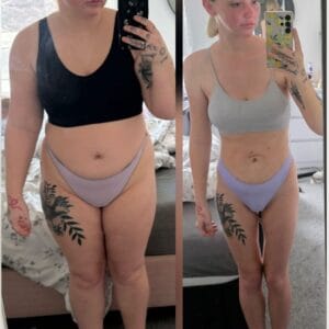 Side-by-side comparison of a female patient's silhouette before and 12 months after a gastric sleeve procedure, displaying successful long-term weight reduction.