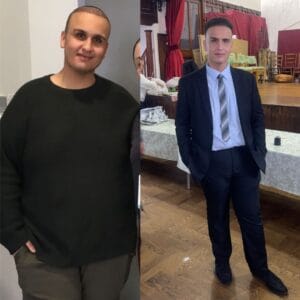 Before and after photos of a male UK patient, showing incredible fat loss and improved muscle definition 18 months post-op from a sleeve gastrectomy.