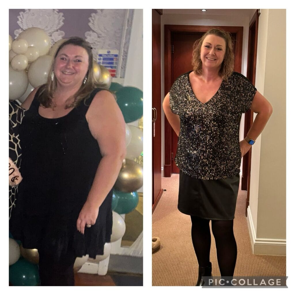 A side-by-side photo transformation of UK patient, showing her dramatic weight loss and radiant smile after an all-inclusive gastric sleeve surgery in Turkey organized by Renovated Me.