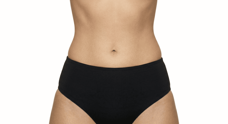 A close-up profile of a patient's flat, contoured abdomen following a tummy tuck surgery combined with advanced 360 liposuction to sculpt the waistline.